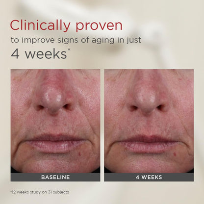 EltaMD UV Elements Tinted Sunscreen SPF 44 48g - before and after comparison (view 2)