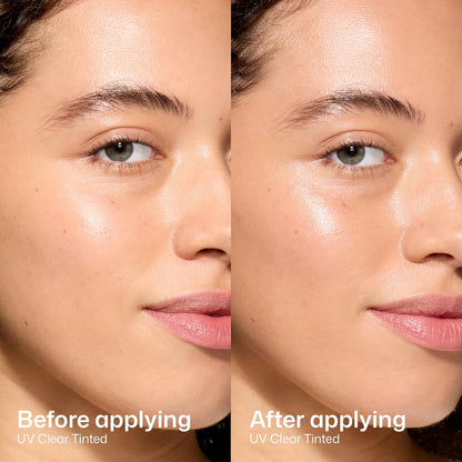 EltaMD UV Clear Tinted Sunscreen SPF 46 48g - before and after comparison