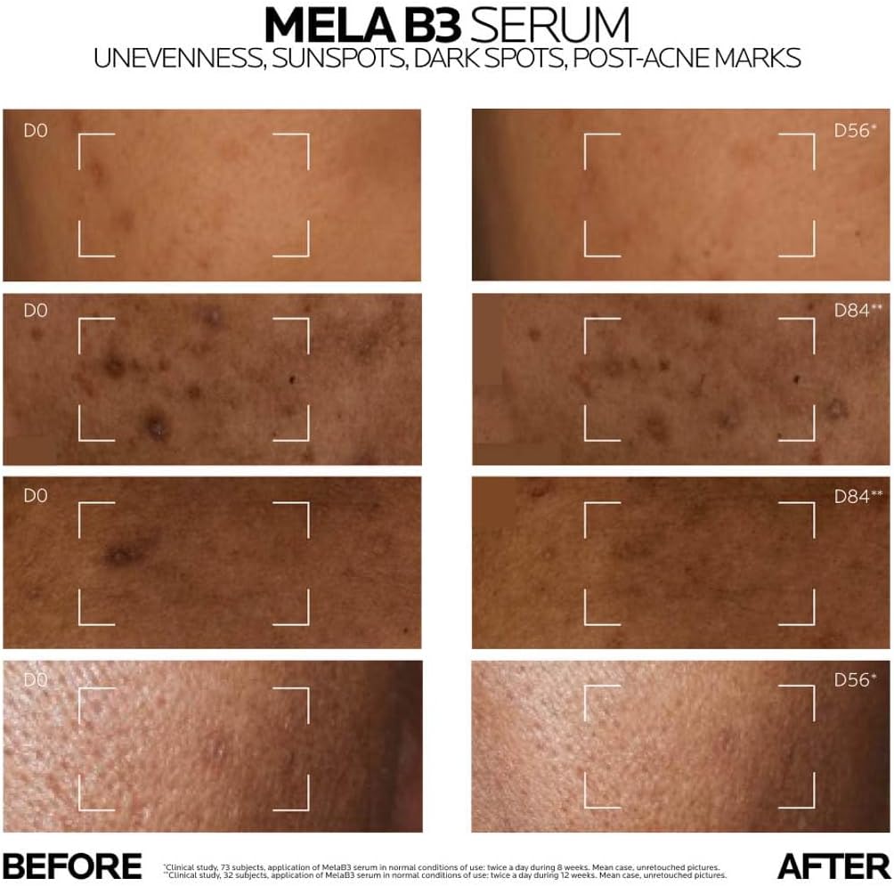 La Roche-Posay Mela B3 Niacinamide Serum 30ML