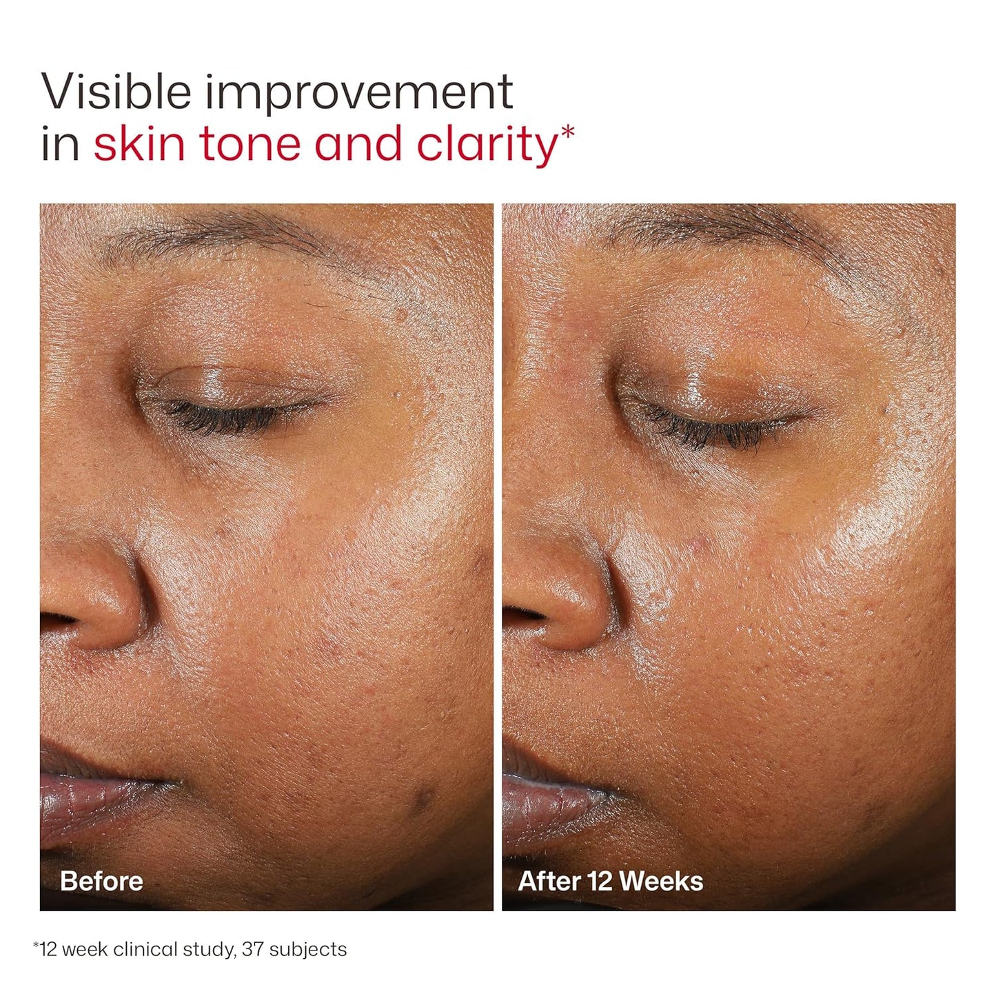 EltaMD UV Clear Tinted Sunscreen SPF 46 48g