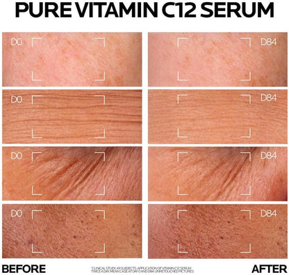 La Roche-Posay 12% Vitamin C Brightening Serum - before and after comparison